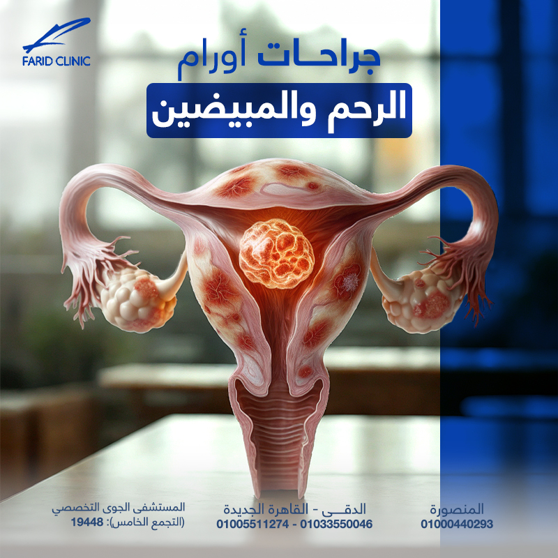 جراحات أورام الرحم والمبيضين